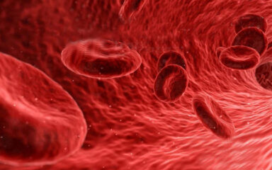 plasmaferesis